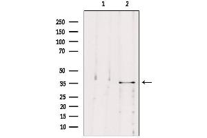 Western blot analysis of extracts from B16F10, using MAST4 Antibody. (MAST4 anticorps  (N-Term))