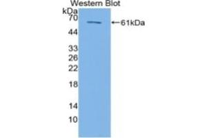WB of Protein Standard: different control antibodies against Highly purified E. (HSPD1 Kit ELISA)