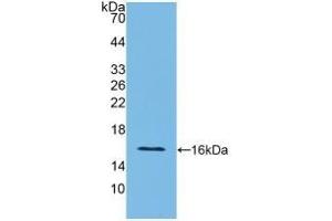Detection of Recombinant IFNg, Rat using Polyclonal Antibody to Interferon Gamma (IFNg) (Interferon gamma anticorps  (AA 23-156))