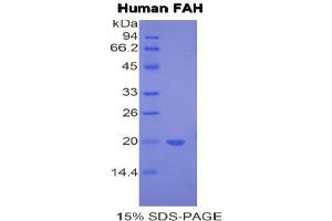 SDS-PAGE analysis of Human FAH Protein. (FAH Protéine)
