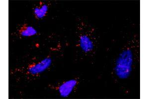 Proximity Ligation Analysis of protein-protein interactions between PIK3R1 and SHC1.