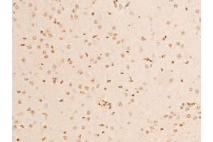 ABIN6267069 at 1/100 staining mouse brain tissue sections by IHC-P.
