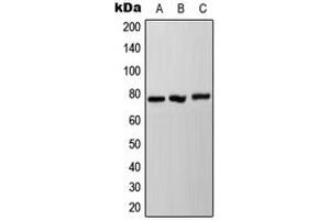 Western blot analysis of NDUFS1 expression in HeLa (A), SP2/0 (B), PC12 (C) whole cell lysates. (NDUFS1 anticorps  (C-Term))