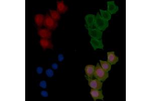 ABIN6255486 and ABIN6277780 staining Hela cells(30 min of UV treatment) by IF/ICC. (PKC epsilon anticorps  (pSer729))