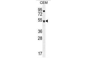 Western blot analysis using TBC1D13 Antibody (Center) Cat. (TBC1D13 anticorps  (Middle Region))
