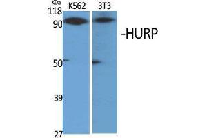 Western Blot (WB) analysis of specific cells using HURP Polyclonal Antibody. (DLGAP5 anticorps  (C-Term))