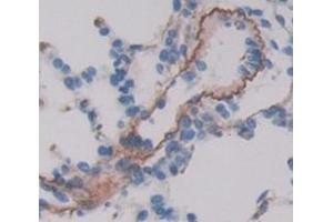 IHC-P analysis of Kidney tissue, with DAB staining. (VIPR1 anticorps  (AA 34-146))