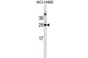 Western Blotting (WB) image for anti-Galectin 3 (LGALS3) antibody (ABIN2995387) (Galectin 3 anticorps)