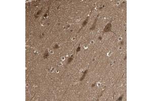 Immunohistochemical staining of human cerebral cortex with YWHAQ polyclonal antibody  shows strong cytoplasmic positivity in neuronal cells and glial cells. (YWHAB anticorps)