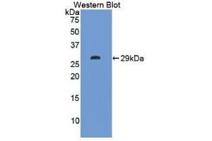 Western blot analysis of the recombinant protein. (ITLN1/Omentin anticorps  (AA 31-253))