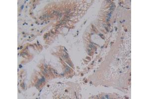 Used in DAB staining on fromalin fixed paraffin- embedded Kidney tissue (Phospholipase C beta 3, Phosphoinositide Specific (AA 318-468) anticorps)