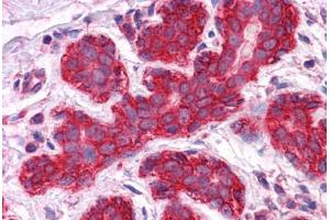 Human Breast: Formalin-Fixed, Paraffin-Embedded (FFPE) (JUP anticorps  (AA 1-746))