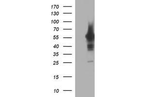 Image no. 1 for anti-Tyrosine Hydroxylase (TH) antibody (ABIN1501369) (Tyrosine Hydroxylase anticorps)