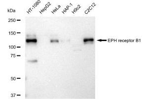 Western blotting analysis using EPH receptor B1 antibody (ABIN7798455). (Recombinant EPH Receptor B1 anticorps)
