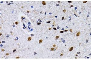 Immunohistochemistry of paraffin-embedded Rat brain using ID3 Polyclonal Antibody at dilution of 1:200 (40x lens). (ID3 anticorps)