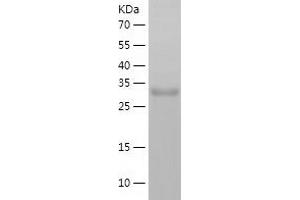 Western Blotting (WB) image for NmrA-Like Family Domain Containing 1 (NMRAL1) (AA 1-299) protein (His-IF2DI Tag) (ABIN7124187)