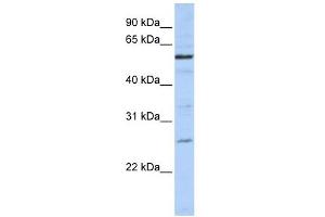 ZGPAT antibody used at 1 ug/ml to detect target protein.