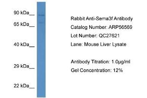 Western Blotting (WB) image for anti-Sema Domain, Immunoglobulin Domain (Ig), Short Basic Domain, Secreted, (Semaphorin) 3F (SEMA3F) (N-Term) antibody (ABIN2786778)
