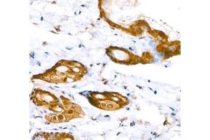 Immunohistochemistry of paraffin embedded mouse skin using Annexin-A8 (ABIN7073071) at dilution of 1: 1600 (400x lens) (Annexin VIII anticorps)