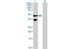 Western Blot analysis of TNFRSF10B expression in transfected 293T cell line by TNFRSF10B MaxPab polyclonal antibody. (TNFRSF10B anticorps  (AA 1-440))
