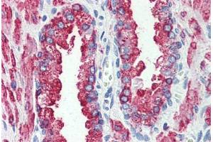 Prostate, Human: Formalin-Fixed, Paraffin-Embedded (FFPE) (GPR146 anticorps  (Internal Region))