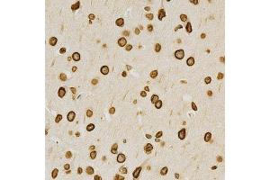 Immunohistochemistry of paraffin-embedded mouse brain using Lamin A/C antibody.