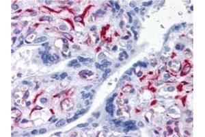 Immunohistochemistry (IHC) image for anti-Solute Carrier Family 44, Member 2 (SLC44A2) (AA 123-231) antibody (ABIN614725)