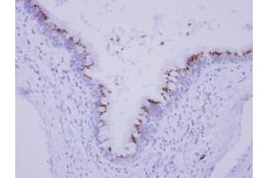 anti-Family with Sequence Similarity 164, Member A (FAM164A) (AA 61-261) antibody