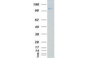 Validation with Western Blot