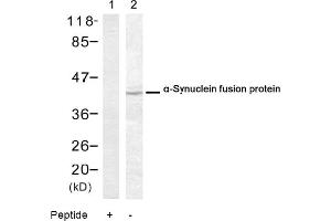 Image no. 1 for anti-Synuclein, alpha (SNCA) (Ser129) antibody (ABIN319324) (SNCA anticorps  (Ser129))