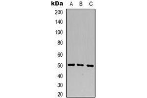 Western blot analysis of B4GALT1 expression in HL60 (A), HEK293T (B), Jurkat (C) whole cell lysates.