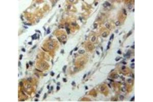 Used in DAB staining on fromalin fixed paraffin-embedded Stomach tissue (CXCL17 anticorps  (AA 24-119))