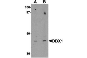 Western blot analysis of DBX1 in mouse kidney tissue lysate with DBX1 antibody at (A) 1 and (B) 2 μg/mL. (DBX1 anticorps  (Middle Region))