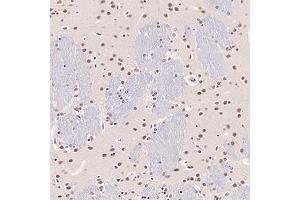 Immunohistochemistry analysis of paraffin-embedded rat brain using,GTF2F2 (ABIN7074036) at dilution of 1: 3000