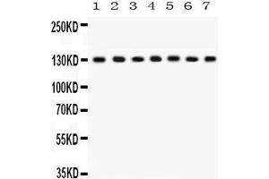 Western Blotting (WB) image for anti-Discs, Large Homolog 1 (DLG1) (AA 1-165) antibody (ABIN3043562) (DLG1 anticorps  (AA 1-165))