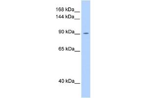 WB Suggested Anti-OSMR Antibody Titration:  0. (Oncostatin M Receptor anticorps  (N-Term))