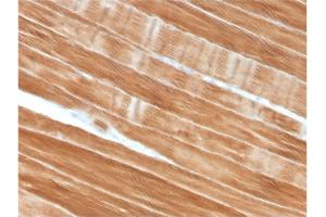 Formalin-fixed, paraffin-embedded human Skeletal Muscle stained with Sarcomeric Actinin Alpha 2 Mouse Monoclonal Antibody (ACTN2/3292).