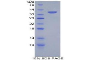SDS-PAGE analysis of Human SPINK1 Protein. (SPINK1 Protéine)