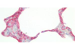 Detection of CAV1 in Human Lung Tissue using Polyclonal Antibody to Caveolin 1 (CAV1)