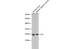 Western blot analysis of extracts of various cell lines, using  antibody (ABIN6127328, ABIN6136696, ABIN6136697 and ABIN6217467) at 1:1000 dilution. (Adenylate Kinase 1 anticorps  (AA 1-194))