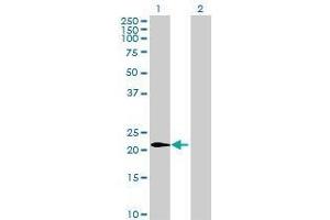 Lane 1: GPSM1 transfected lysate ( 18 KDa) Lane 2: Non-transfected lysate. (GPSM1 293T Cell Transient Overexpression Lysate(Denatured))