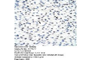 Rabbit Anti-ADAT1 Antibody  Paraffin Embedded Tissue: Human Heart Cellular Data: Myocardial cells Antibody Concentration: 4. (ADAT1 anticorps  (C-Term))