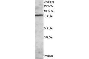 Western Blotting (WB) image for anti-Enhancer of Zeste Homolog 1 (EZH1) (N-Term) antibody (ABIN2465671) (EZH1 anticorps  (N-Term))