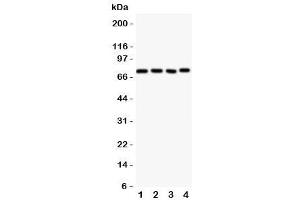 Western blot testing of Tec antbody