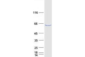 Validation with Western Blot