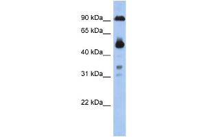 WB Suggested Anti-CCDC144B Antibody Titration: 0. (CCDC144B anticorps  (Middle Region))