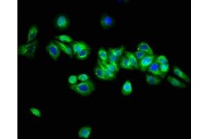 Immunofluorescence staining of HepG2 cells with ABIN7144697 at 1:133, counter-stained with DAPI.