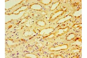 Immunohistochemistry of paraffin-embedded human kidney tissue using ABIN7146703 at dilution of 1:100