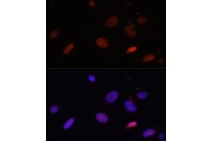 Immunofluorescence analysis of U-2 OS cells using Histone H1. (Histone H1 anticorps  (AA 1-194))