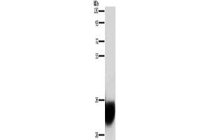 Western Blotting (WB) image for anti-Glycoprotein M6A (GPM6A) antibody (ABIN2429473) (GPM6A anticorps)